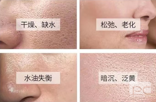 SkinH纳米氢玻尿酸：抗老必入宝藏国货精华推荐